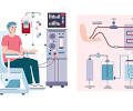 Dialysis